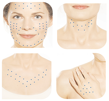 skin-booster-regije Skin booster za obraz, vrat, dekolte in roke.