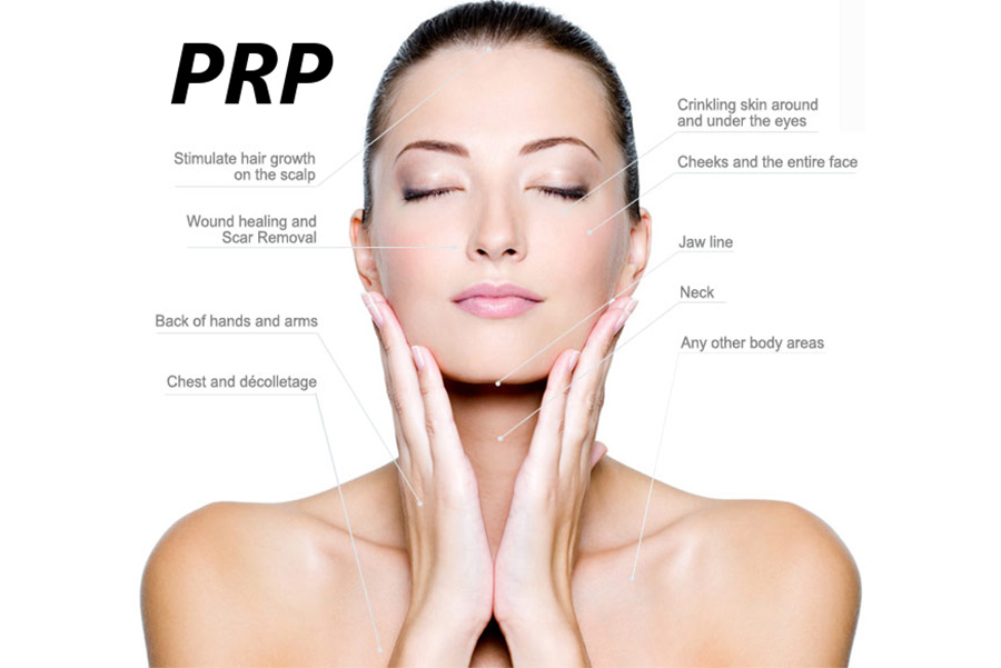 accent on skin PRP treatment wellington