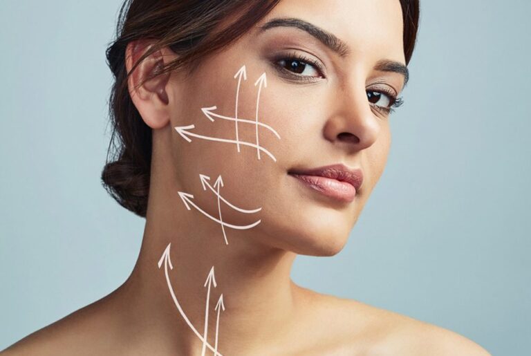 profhilo3-768x515 Profhilo za obraz in vrat